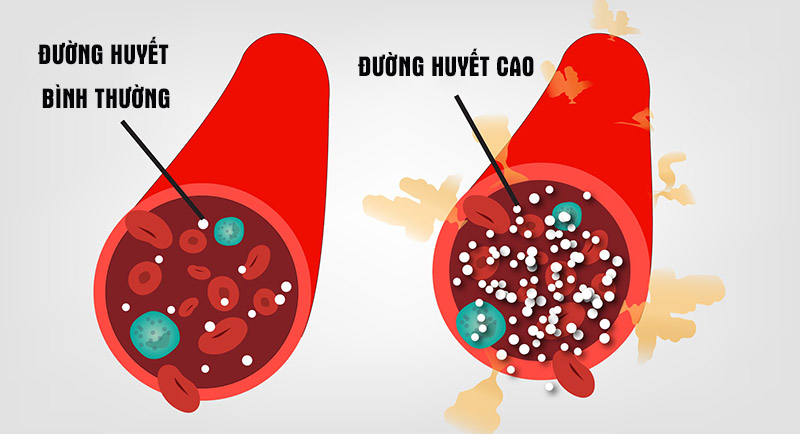 tieu-duong-co-chua-duoc-khong