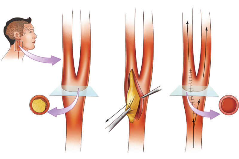 dieu-tri-thieu-mau-nao