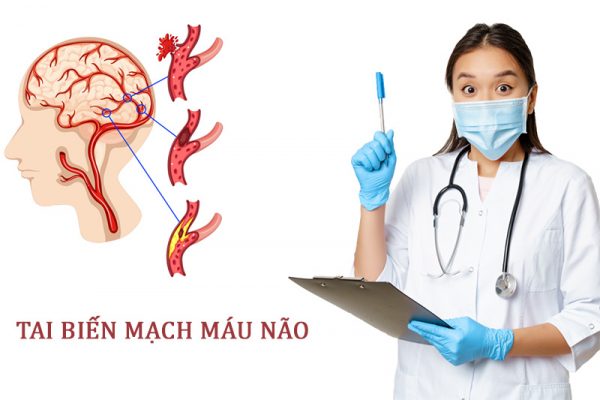 dieu-tri-tai-bien-mach-mau-nao