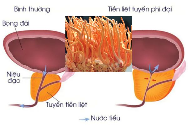 Dong-trung-ha-thao-ho-tro-tuyen-tien-liet