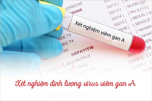 Viem-gan-A-co-the-duoc-phat-hien-bang-cach-xet-nghiem-mau