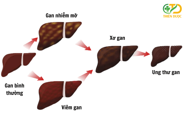 bien-chung-cua-benh-viem-gan-c