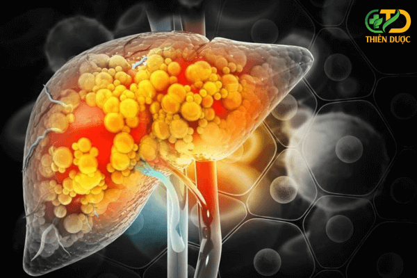 gan-nhiem-doc-nguy-hiem-nhu-the-nao