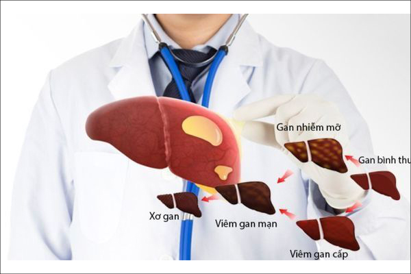 cac-giai-doan-cua-gan-nhiem-mo