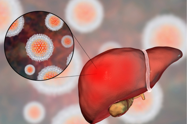 nguyen-nhan-benh-viem-gan-cap