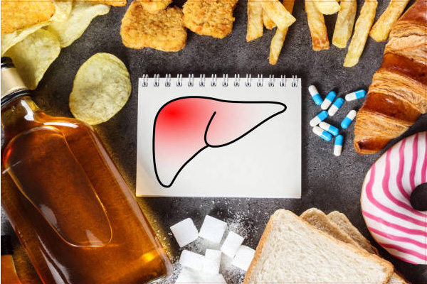 nhung-thuc-pham-xau-gay-hai-cho-gan