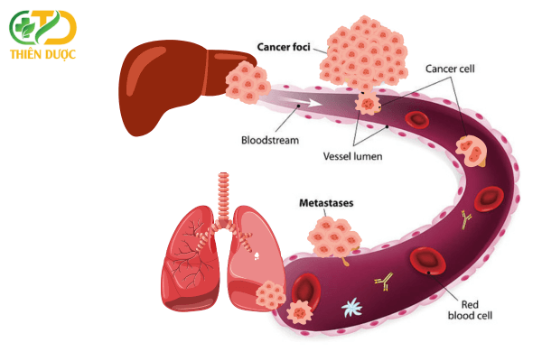 ung-thu-gan-di-can-sang-phoi
