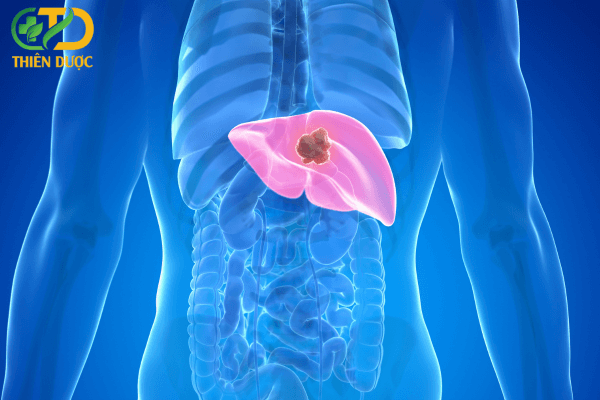 ung-thu-gan-noi-lo-so-cua-con-nguoi