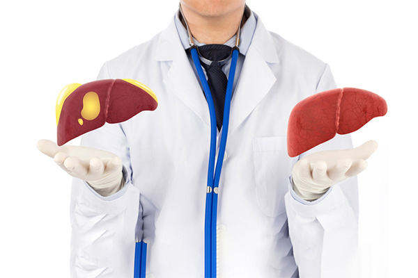 Cach-dieu-tri-gan-nhiem-mo-theo-khoa-hoc