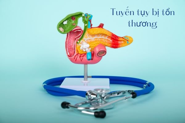 Tuyen-tuy-bi-ton-thuong