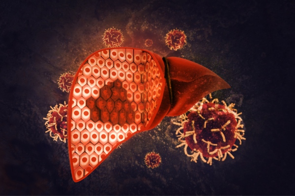 nguyen-nhan-gay-benh-gan