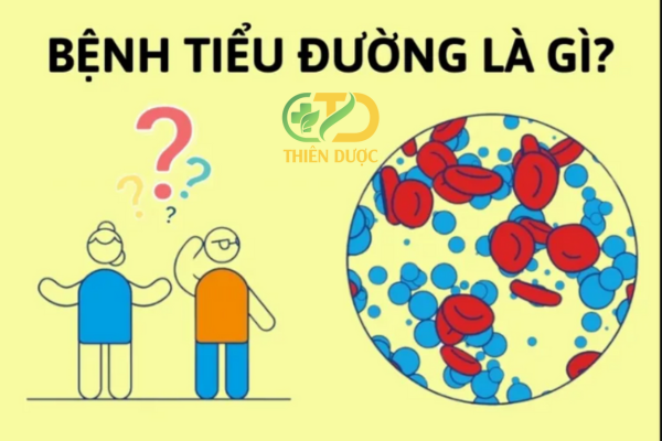 Benh-tieu-duong-la-gi