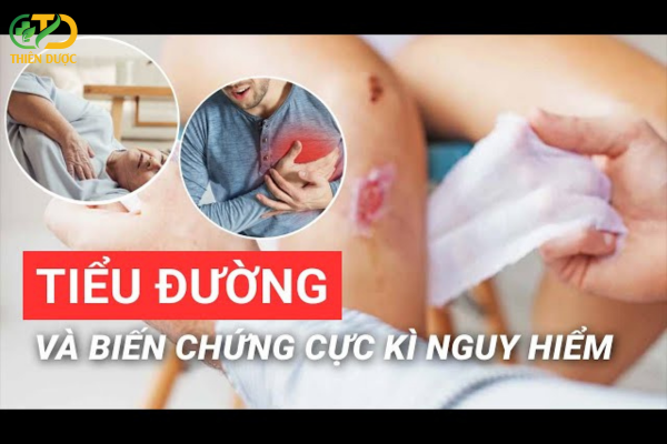 Su-nguy-hiem-cua-bien-chung-tieu-duong