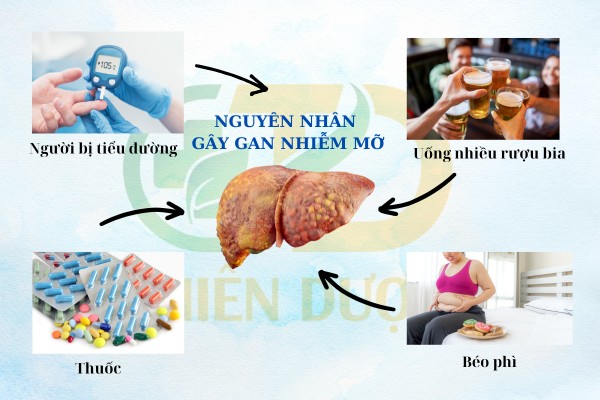 cac-nguyen-nhan-dan-den-gan-nhiem-mo