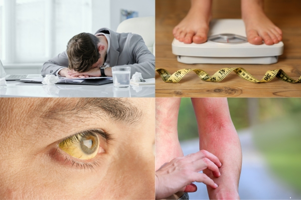 nhung-trieu-chung-thuong-gap