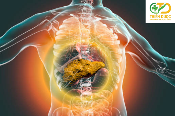 xo-gan-la-giai-doan-nghiem-trong-cua-suy-giam-chuc-nang-gan