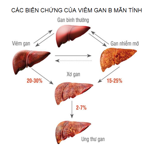 Cac-bien-chung-cua-viem-gan-B