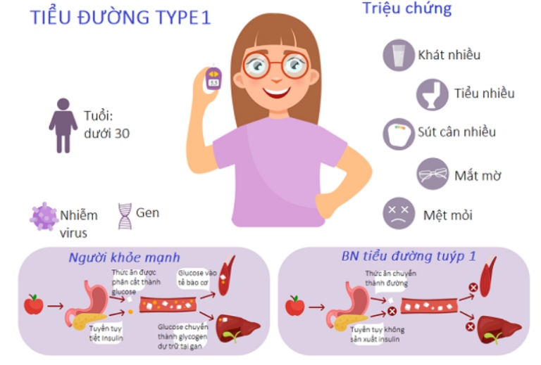 trieu-chung-tieu-duong-type-1