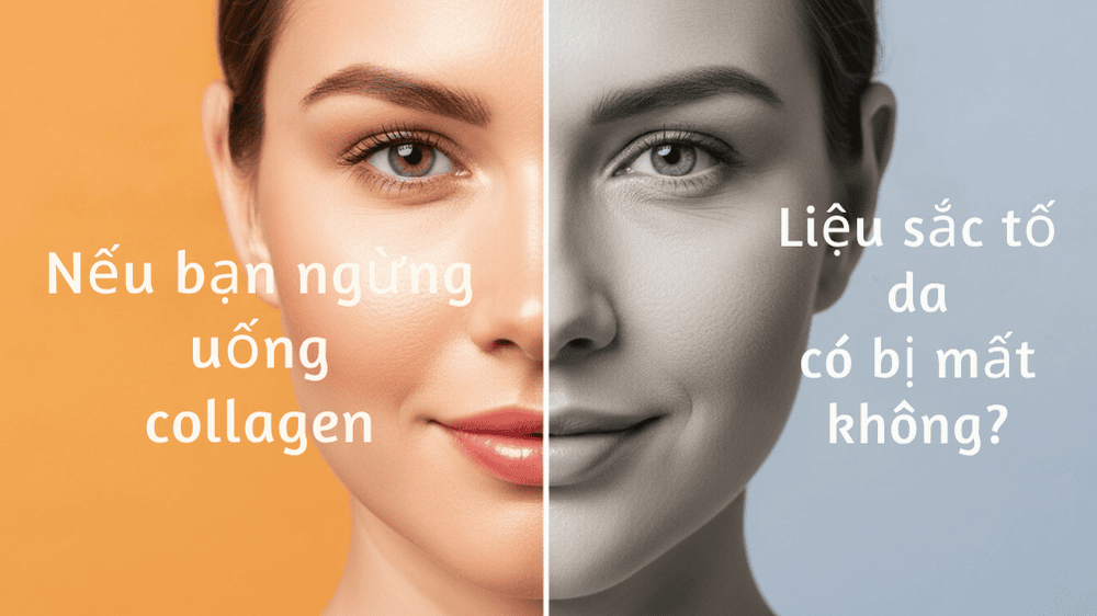 lo-so-phu-thuoc-collagen